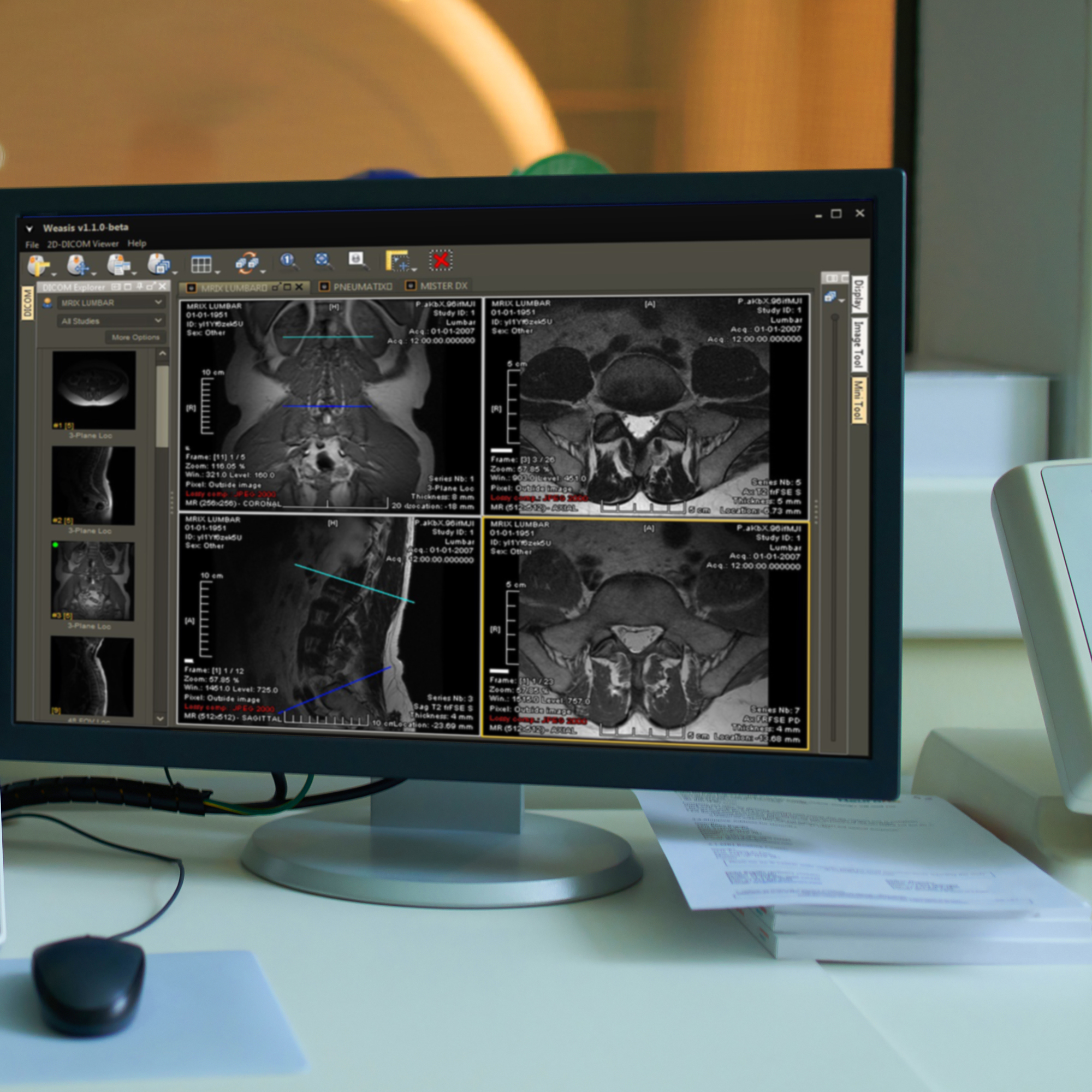 Magnetic Resonance Imaging machine from control room – a series